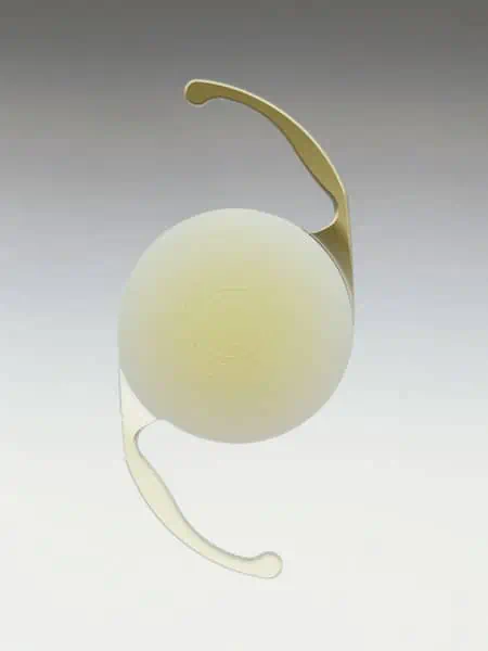 Diagram of a multifocal intraocular lens